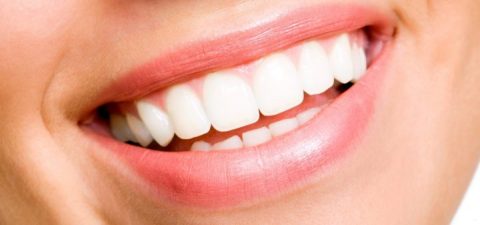 estética dental
