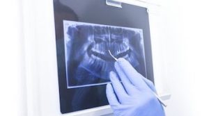 como se toman la radiografías dentales