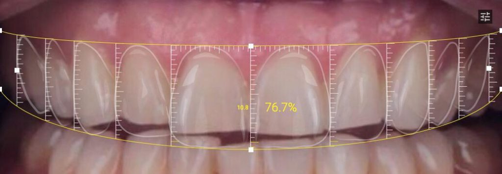 dientes