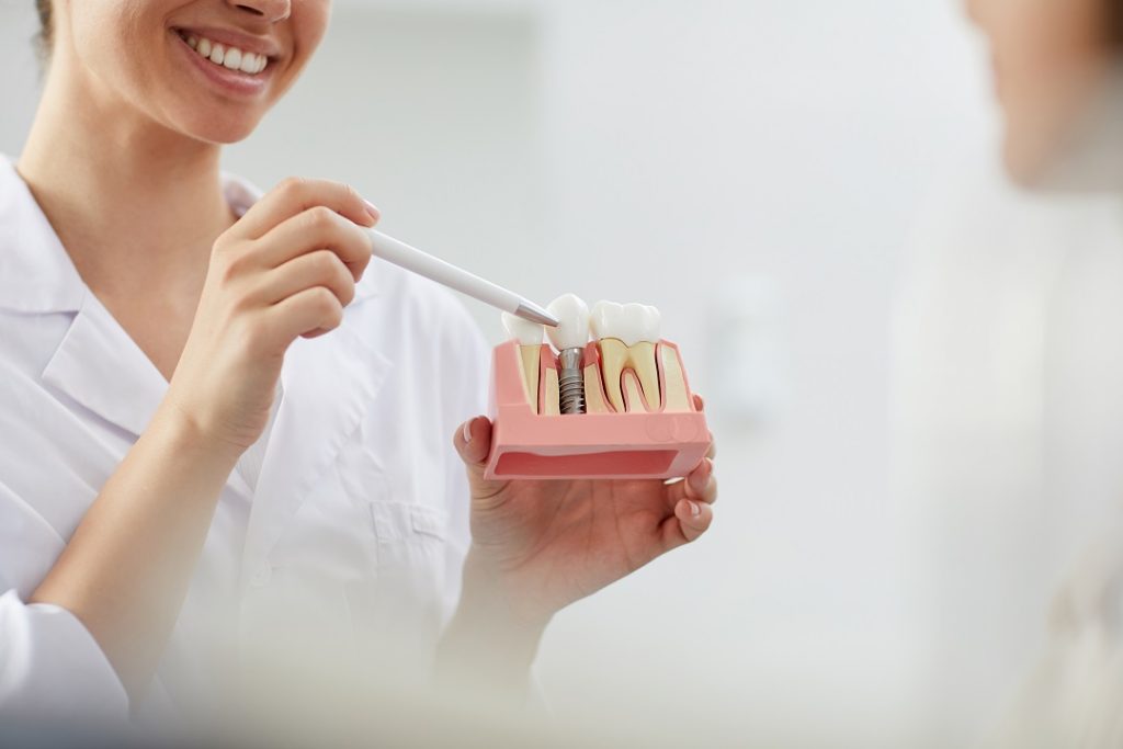 Dentista sonriente explicando los tipos de implantes dentales