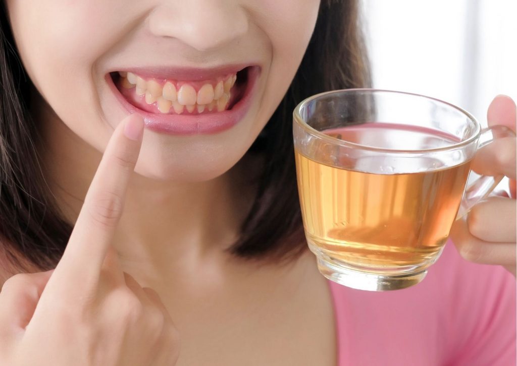 mujer con una taza de té y mostrando con su dedo índice sus dientes amarillos.