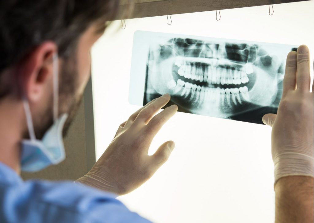 dentista de espaldas revisa una radiografía panorámica en una tabla de luz. Tema: tipos de radiografías dentales
