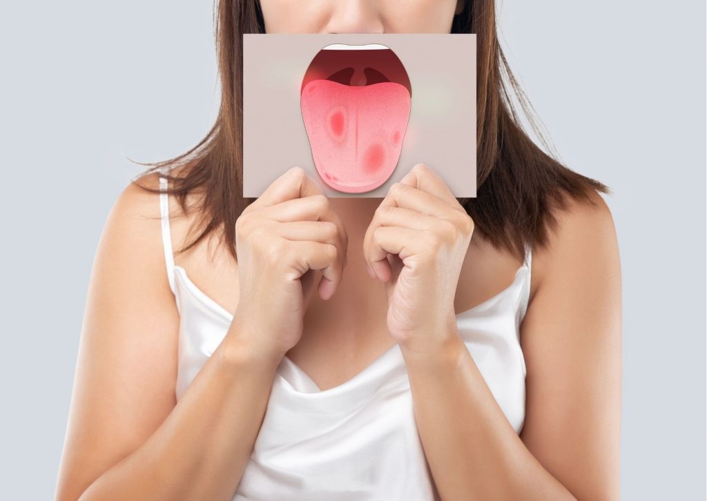 Mujer sujeta frente a su cara una lámina que contiene un dibujo de una lengua con manchas rojas. tema: enfermedades de la lengua