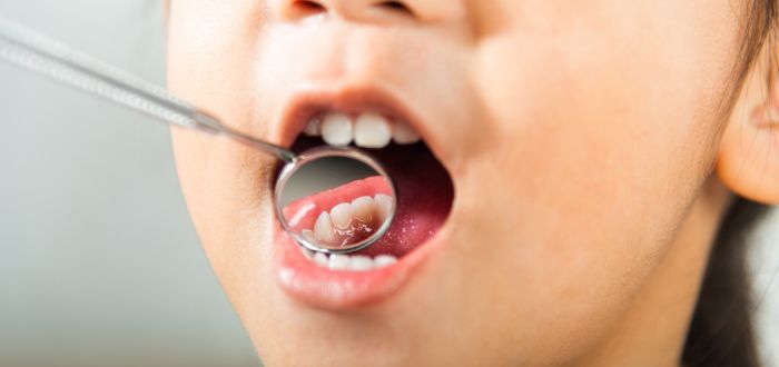 niña en el dentista para diagnóstico de caries