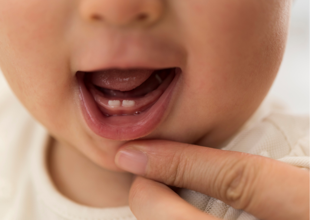 Primerísimo primer plano a boca de bebé, mientras dedo de mujer adulta le baja el labio para mostrar la encía de la arcada inferior en que solo se ven dos pequeños dientes de leche. Tema: Por qué es importante cuidar los dientes de leche. Nota para Everest Life
