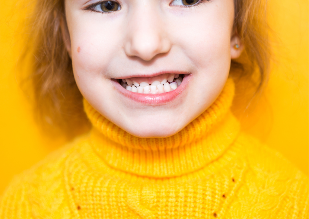 Niña con sweater amarillo muestra sus dientes con mordida cruzada. Tema: maloclusión dental de Blog Everest Life