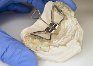 Expansor de paladar en un molde de yeso de la boca de un paciente. tema: paladar ojival para blog Everest Life
