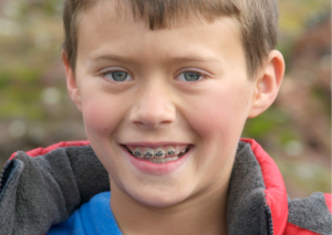 Niño rubio con brackets en sus dientes sonríe a la cámara: Tema: señales que tu hijo necesita brackets, para blog Everest Life