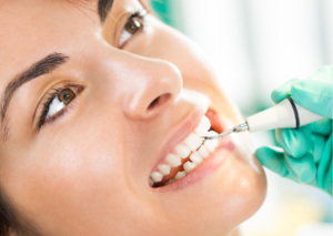 Primer plano de paciente en la cínica dental a la que están realizando una limpieza dental Tema: diferencias entre Raspado y limpieza dental para blog Everest Life

