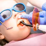 Restauración dental con resina a una niña pequeña. Dentista utiliza luz de curado ultravioleta