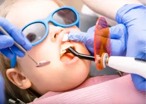 Restauración dental con resina a una niña pequeña. Dentista utiliza luz de curado ultravioleta