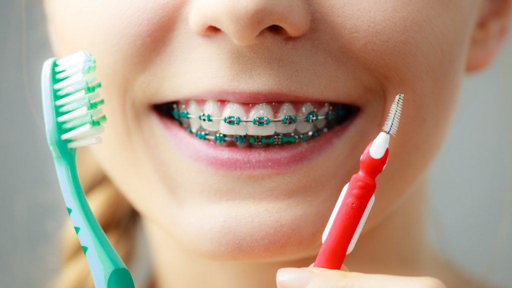 cepillarse los dientes con frenillos