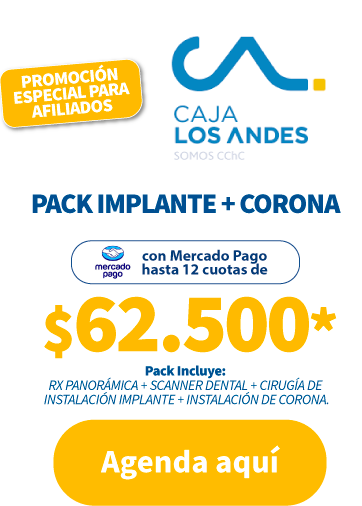 caluga-precio