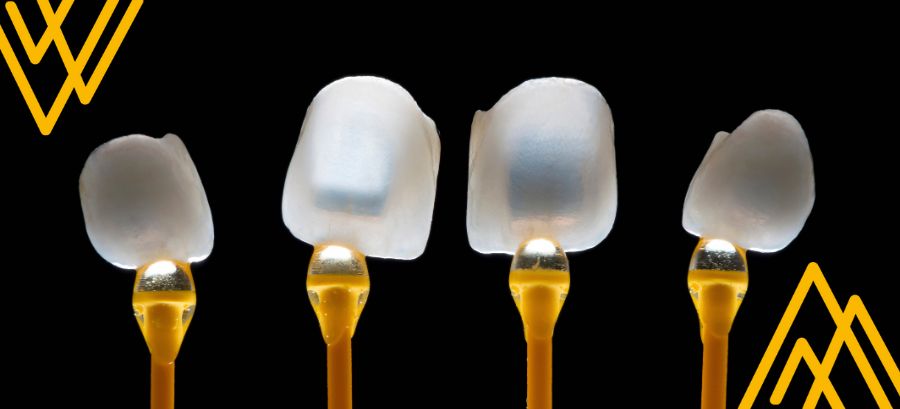 Cuatro carillas dentales. Contexto: blanqueamiento de las carillas dentales