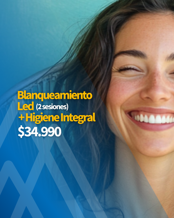 blanqueamiento-led