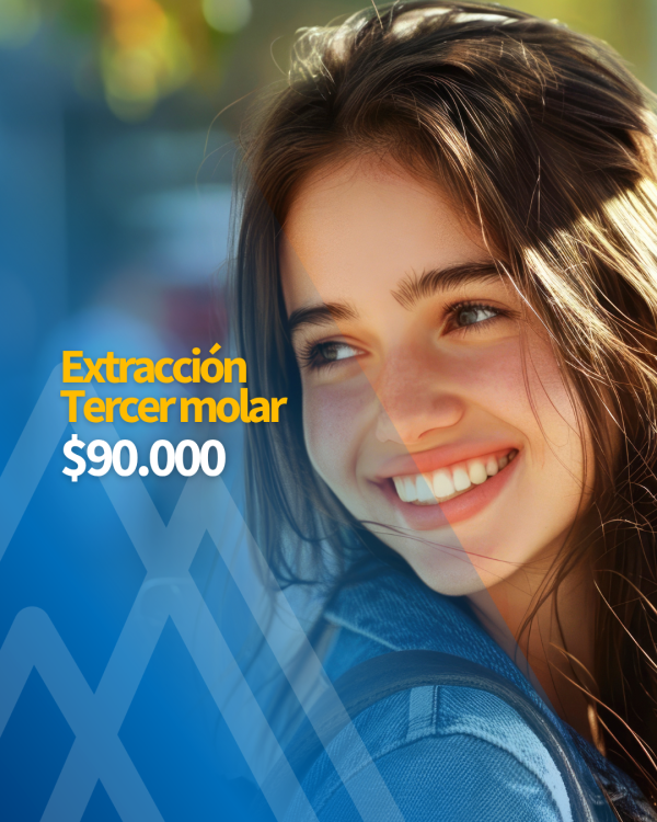 extracción-tercer-molar